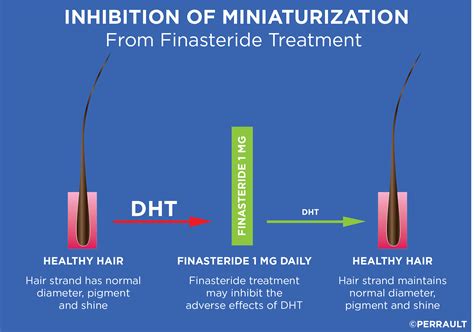 What increases DHT in scalp?