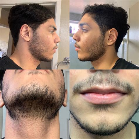 What is 4 month facial hair?