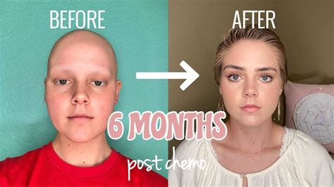 What is 6 months of chemo?