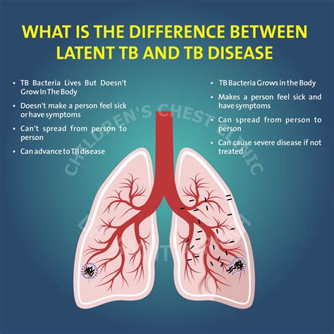 What is EB vs TB?