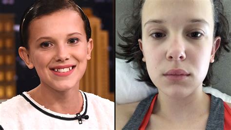 What is Millie Bobby Brown's serious problem?