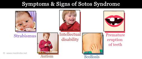 What is Sotos syndrome?