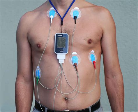 What is a 3 lead holter?