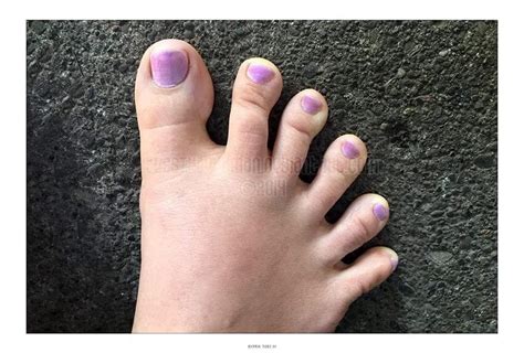 What is a 7 toe?
