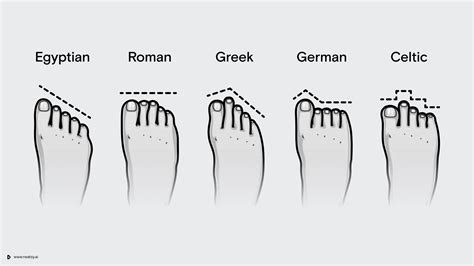What is a German foot shape?