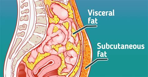 What is a bad visceral fat number?