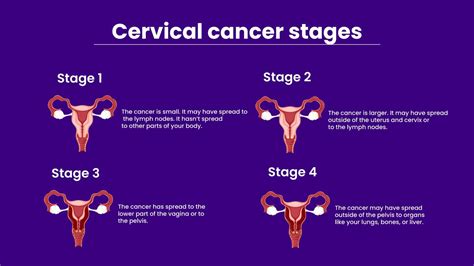 What is a classic symptom of cervical cancer?