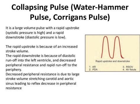 What is a collapsing pulse?