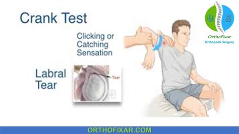 What is a cranking test?