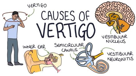 What is a false sense of dizziness?