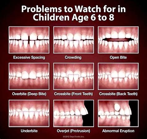 What is a good age to get braces?