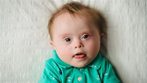 What is a high chance of Down syndrome?