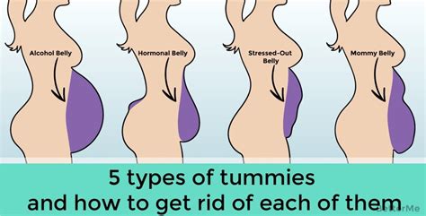 What is a mommy's belly type?