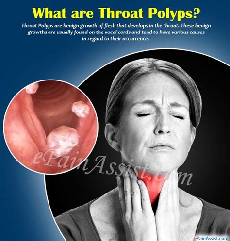 What is a mouth polyp?