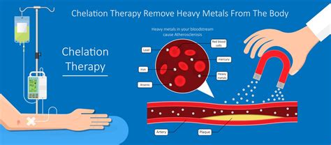 What is a natural chelation for mercury?