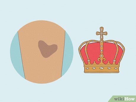 What is a royal birthmark?