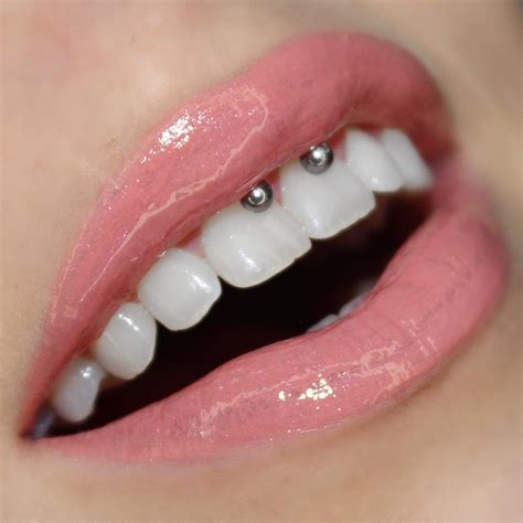 What is a smiley piercing?