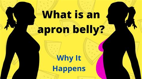 What is an apron belly?