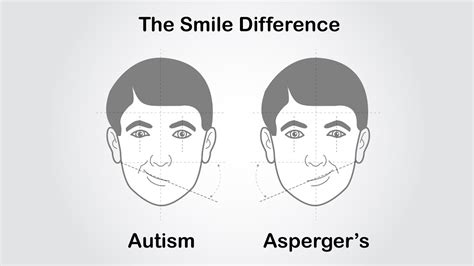What is autism smile?