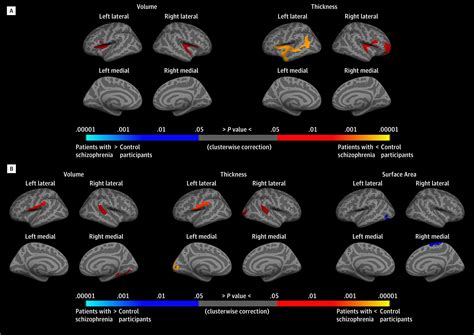 What is average IQ of schizophrenia?