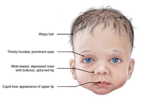 What is baby facial hair?