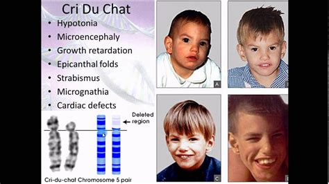 What is chromosome 10 disorder?