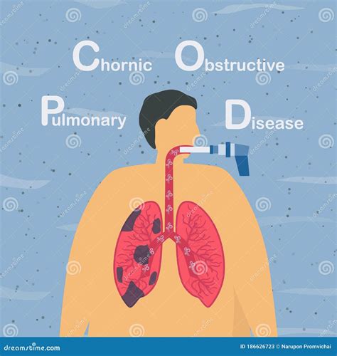 What is considered poor lung function?