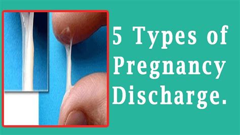 What is early pregnancy discharge like?