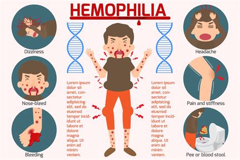 What is emophilia?