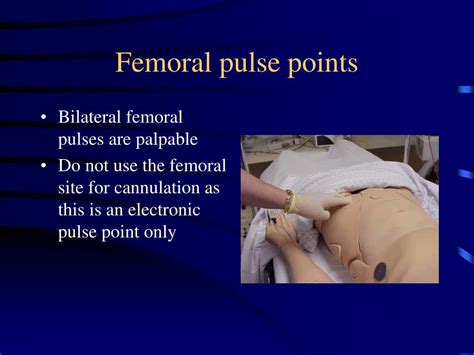 What is femoral pulse?