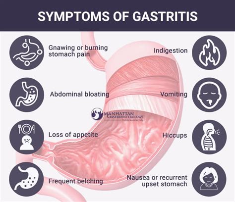 What is gastritis burping?