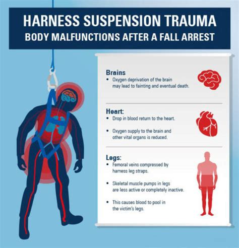 What is harness hang syndrome?