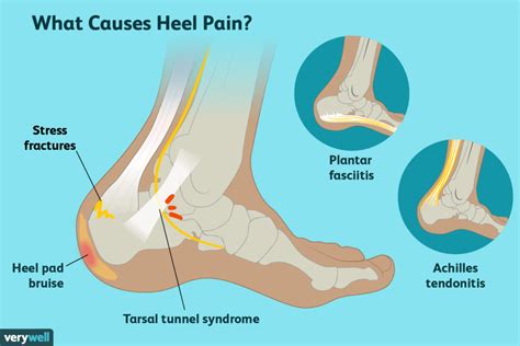 What is heel in Old English?