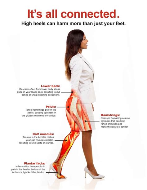 What is high heel syndrome?