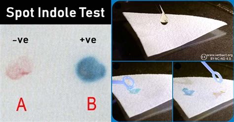 What is indole spot test E. coli?