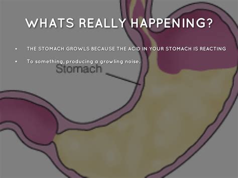 What is it called when stomach growls?