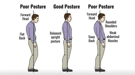 What is lazy posture?