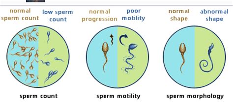 What is low quality sperm?