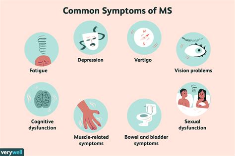 What is most commonly mistaken for MS?