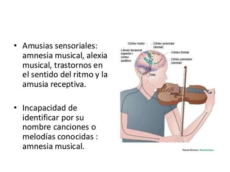 What is musical agnosia?