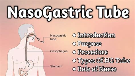 What is nasogastric tube and its function?