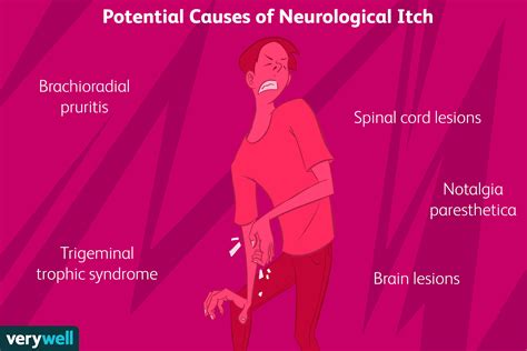 What is neuropathic itch?