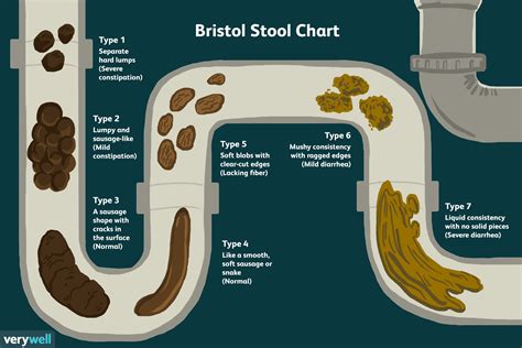 What is removing stool with fingers called?