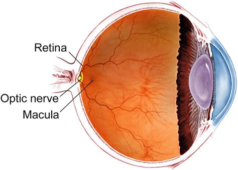 What is retinal glare?