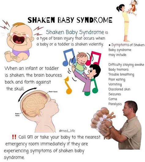 What is shaking syndrome?