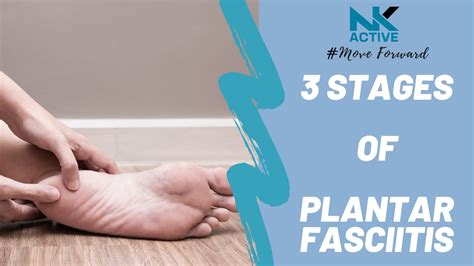 What is stage 3 plantar fasciitis?