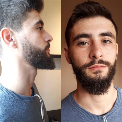 What is the 3 month beard rule?