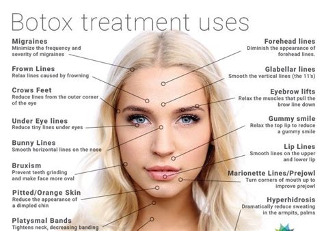 What is the 4 hour rule for Botox?