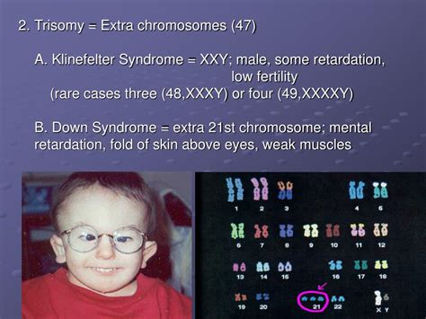 What is the 49 chromosome syndrome?