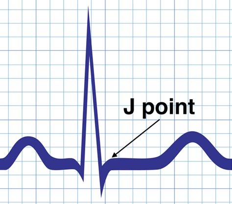 What is the J point?
